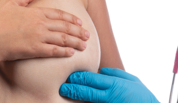 doctor-examining-woman-breast-almazois